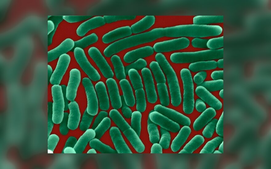 Vandenyje „Tyruma“ – žaliamėlės pseudomonos bakterijos