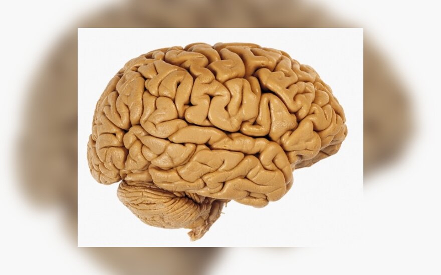 Mobiliųjų telefonų radiacija saugo nuo Alzheimerio ligos