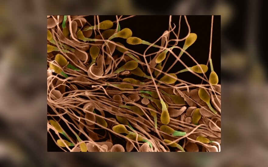 Spermatozoidai