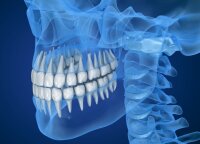 Su šia odontologine problema gyvena apie 80 proc. suaugusiųjų: dauguma nepastebi iki tol, kol pasekmės būna liūdnos