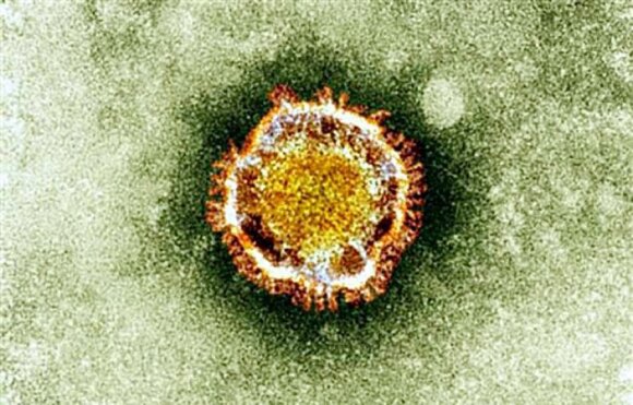 An electron microscope image of the coronavirus.