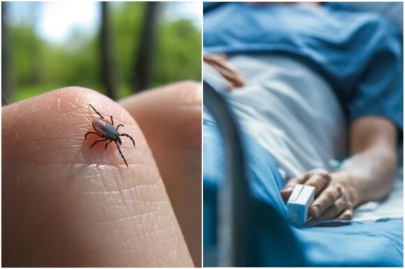 Tick-borne encephalitis