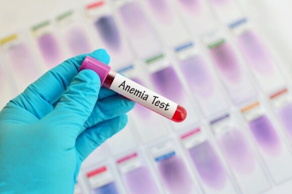 Signs of anemia - your doctor has taught you how to prevent it and how to help yourself when you are sick