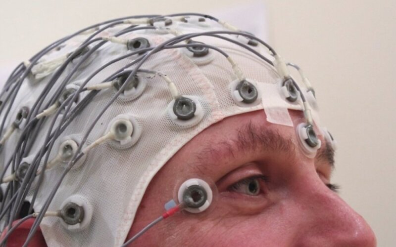 epilepsija