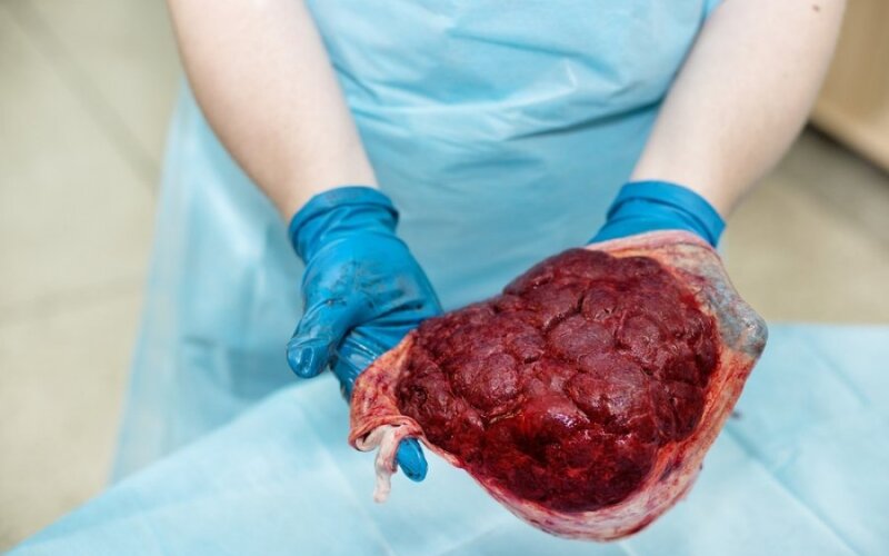 placenta