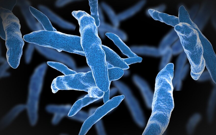 Tuberkuliozę galima išnaikinti iki 2045 metų