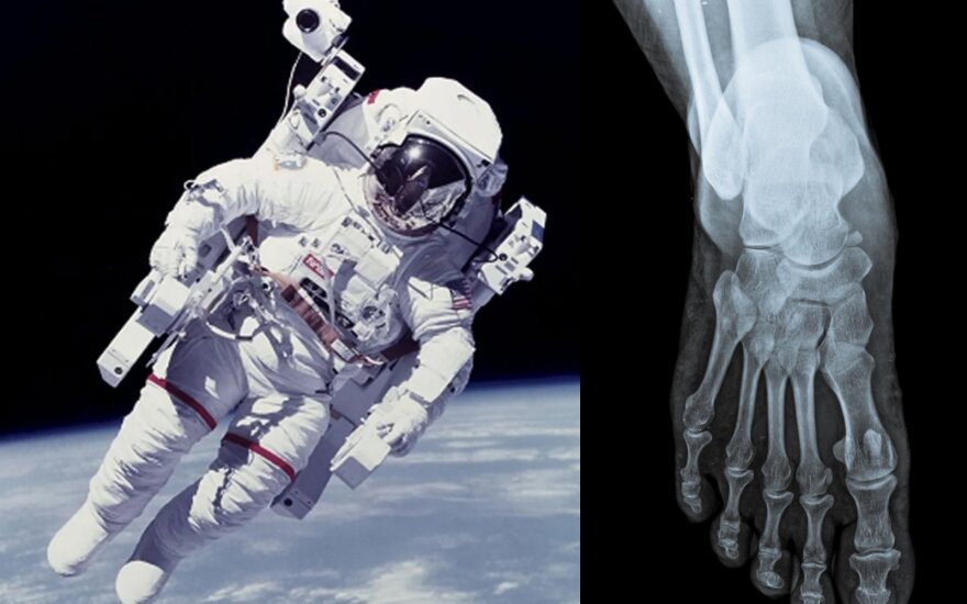 Astronautams kosmose prasideda osteoporozė.