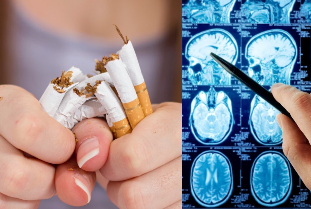 Mesti rūkyti gali padėti smegenų stimuliacija. 