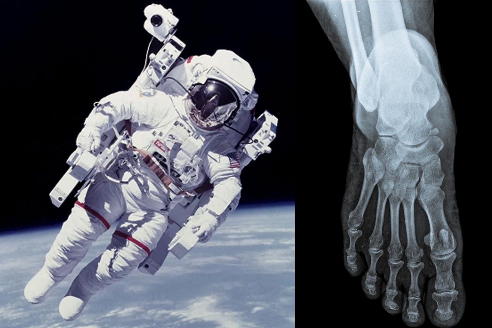 Farlige endringer ble oppdaget i kroppen til astronauter som kom tilbake fra verdensrommet: på bare en måned – irreversible prosesser i beinene